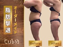 エステティックサロン キュビア(Cubia)/