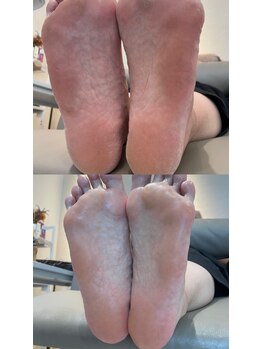 ネイルアトリエ リトム(Nail atelier Litom)/