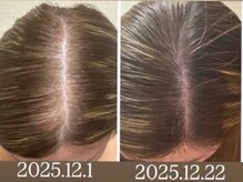 カレント(current)/韓国式！頭皮管理