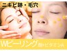【ニキビ・跡/毛穴】Wピーリング(ビタミンA+酸)+VCイオン導入