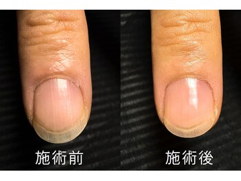 スタンリー(stanly)の写真/【広島にNEW OPEN】自分ではなかなかできないケアは、メンズネイルのプロにお任せ☆大事なイベントの前に！