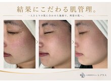 レアリスの雰囲気（目指すのは、その場限りの変化ではない。毛穴/シミ/ニキビ/脱毛）