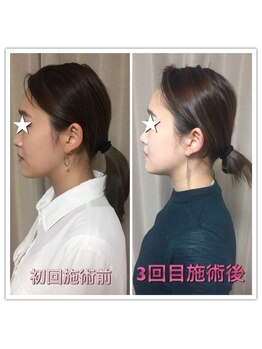 ラ アクサル(la.akthar)/小顔 全身 骨格矯正 整体