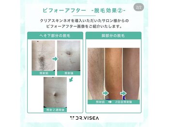 ザ ルード(ZA:RUDO)/脱毛器【クリアスキンネオ】