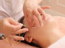 アロマプラス鍼灸院/立体造顔美容鍼