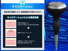 フェレザ 新潟(Felleza)/超音波で脂肪細胞にアプローチ