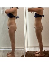 チェリオール(Cherioll)/WINBACKボディ　3か月後