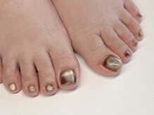 バイオ ナゴヤ(Bio nagoya)/フィルイン・パラジェル変更可