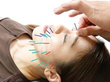 ハリトト鍼灸院/美容鍼灸施術