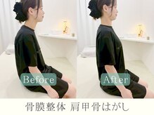 根本改善を考えた施術【整体/肩こり/リンパ】