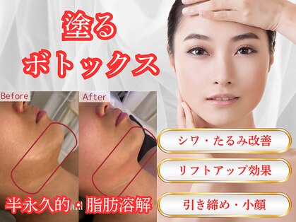 アンシャンテ(Anchant)の写真