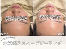 マヴィ 香里園店(MavY.)/お肌ふっくら透け肌へ！