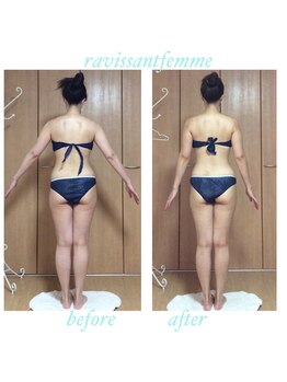 ラヴィソンファム(Ravissant femme)/痩身エステ/ビフォー＆アフター