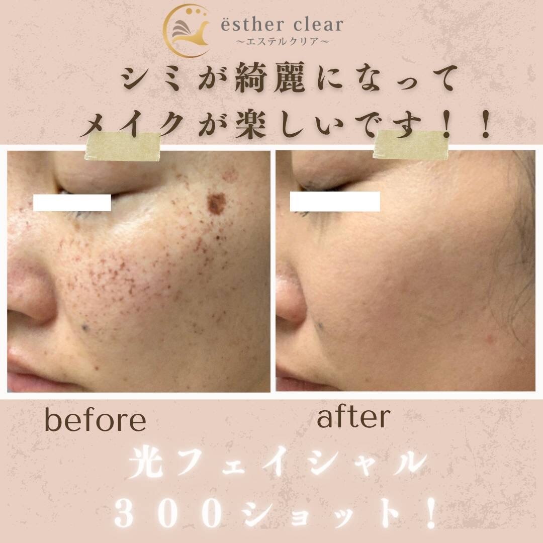エステルクリア(esther clear)|ホットペッパービューティー