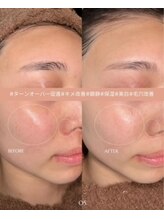 サンク(cinq)/韓国で大人気！ララピール☆彡