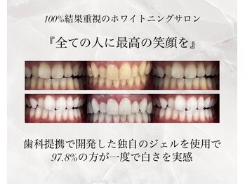 ホワイトニングショップ 堺東店