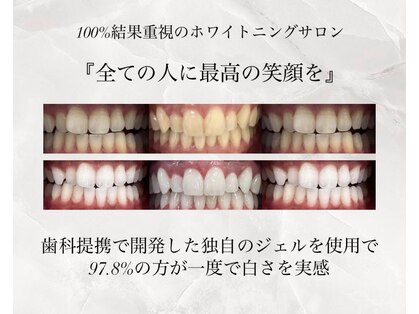 ホワイトニングショップ 堺東店の写真