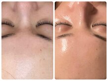 ベルドア(Bell Door)/【ツヤっと美肌ピーリング】