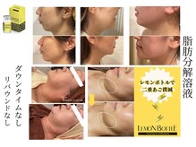 フォーユー 飯能店(Foryou)の雰囲気（レモンボトル結果）