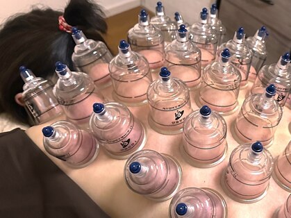 ケアケア(care×care)の写真