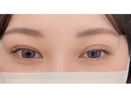 アンレーヴ(unReve)の写真