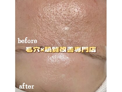 ナチュラ ソース(NatureSouce)の写真