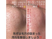 インファイン ハミルトン店(infine)/毛穴を傷つけない