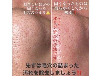 インファイン ハミルトン店(infine)/毛穴を傷つけない