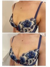 エスビューティー 三軒茶屋(S beauty)/バストケア・三軒茶屋・痩身