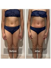 ユーフォリアプラス(euphoria +plus)/痩身くびれ