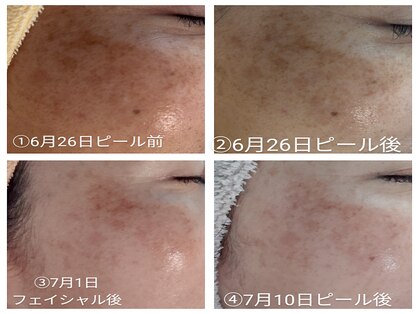 ホロホロ(holoholo)の写真