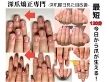 クウ(KUU)の雰囲気（即日見た目改善できるからその日から楽しく深爪矯正できる!）