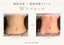 ビュウナ 銀座(BEAUNA)