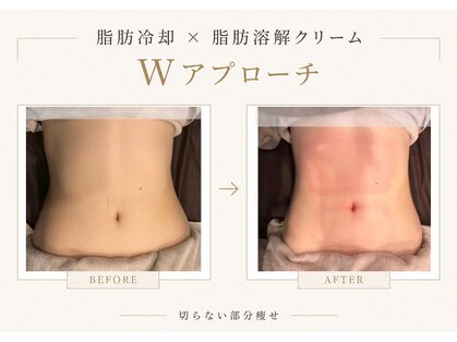 ビュウナ 銀座(BEAUNA)の写真