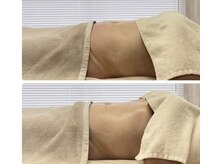 大人女性の痩身専門サロン AVENIR【アヴニール】の雰囲気（ハンドとEMS・高周波マシンを組み合わせることで効果アップ☆）