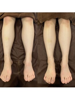 リブリス ボディデザインサロン(rebliss)/リンパケア+筋肉矯正◎30代