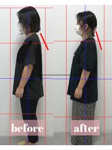 整体アンドボディメイク 禅/【ねこ背矯正】施術回数2回