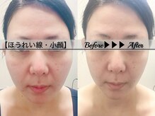 ブラックスワン(Black Swan)/