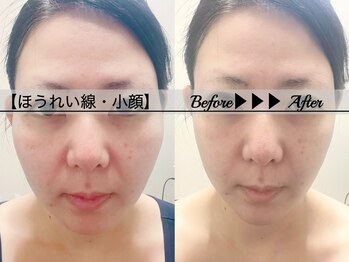 ブラックスワン(Black Swan)/