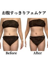 パラアモール(Paraamor)/お腹が痩せていくフェムケア