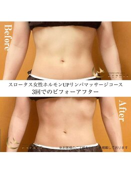 エスプリ 新宿店/痩身・ダイエット新宿