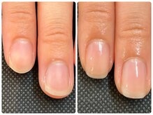 たった3ヶ月で美爪！
