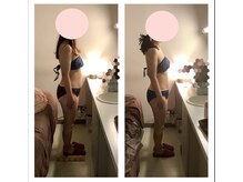 アクア エステティコ 亀有(ACQUA estetico)/脂肪燃焼6回