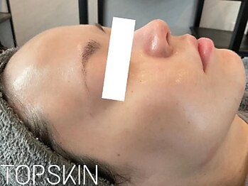 トップスキン 栄(TOPSKIN)/憧れのノーファンデが叶います♪