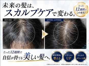BLD/クリニカルスカルプケアB&A