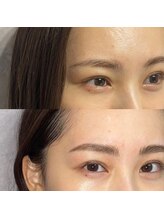 グレーシェル 天神大名店(Gracher)/HBL Before→After