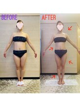 エステティックサロン アール 大阪梅田(esthetic salon R)/40代女性　前