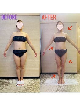 エステティックサロン アール 大阪梅田(esthetic salon R)/40代女性　前