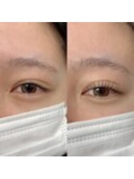 ララディーテ 北島店(LARAdite)/まつ毛パーマ