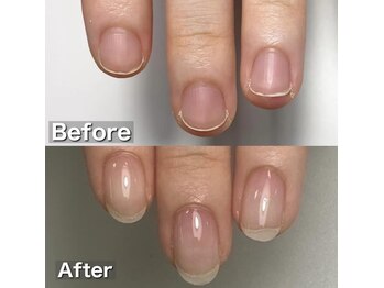 ラピシア(Rapicia)/